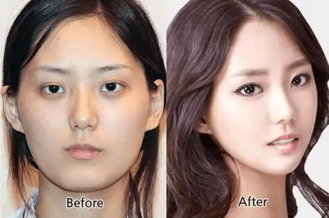 韩国人喜欢去的5家轮廓整形医院