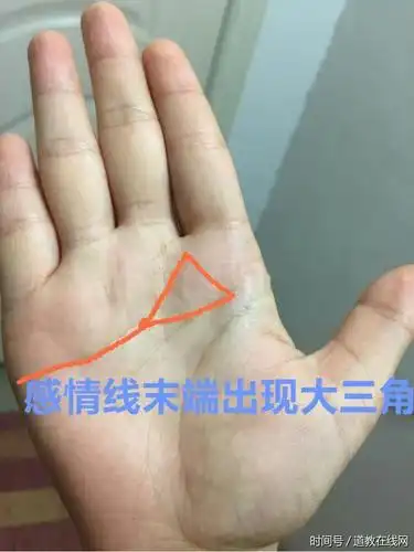 小心,女人"这里"出现了大三角,你老公被人惦记了