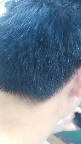 有什么办法能 弄我头上的白头发,不是很多,就是后面一点点