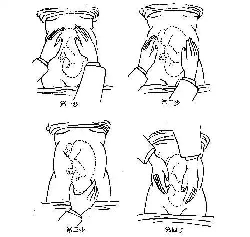 医生怎么检查胎儿入盆