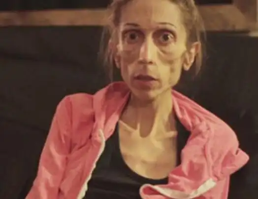 惊呆!摄影师镜头下"行走的骷髅"