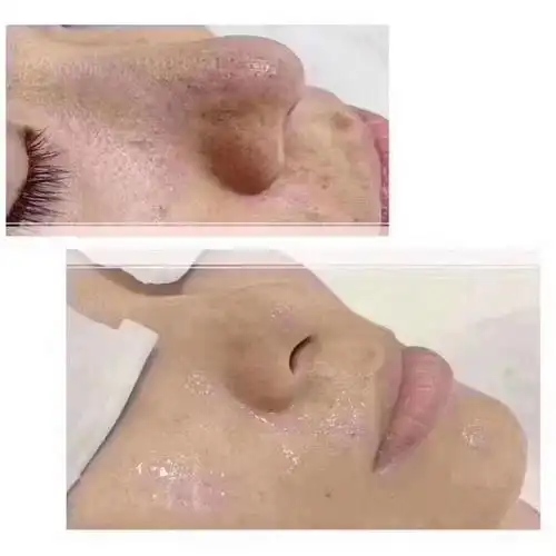 正品顶基海藻小罐洁肤霜美容院毛囊清洁术面部产品去黑头角质粉刺