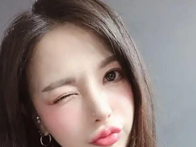 喜欢我的这个嘟嘟唇,现在唇部要变得饱满多了,唇形_圈子-新氧美容整形