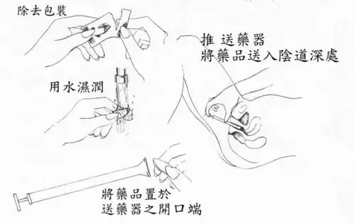 阴道栓剂正确使用须知 健康服务