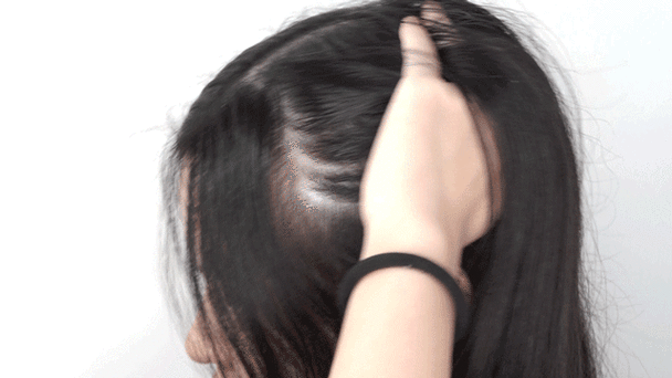 一天比一天少,就连头皮也被小绒毛盖住了,生发的效果实在是太好了"