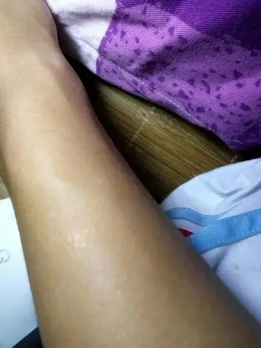 请问我手臂上的白点是怎么回事
