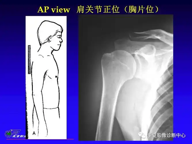 肩关节x线检查特殊体位
