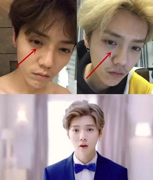 鹿晗的皮肤状态虽然不错,但是依然能看出鹿晗在家似乎也很疲累的样子