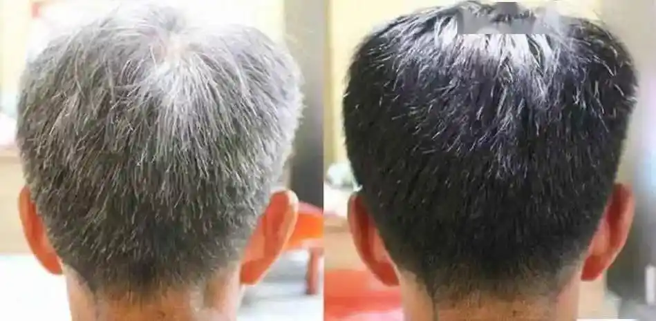 白头发千万别去店里染这样白发变黑发简单又健康年轻又漂亮