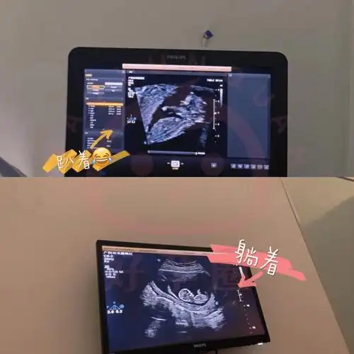 深圳市第三人民医院医院产检须知(附孕妈经验分享)_检查_胎儿_进行