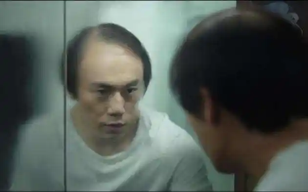 《隐秘的角落》秦昊一张"秃头照"出圈,医生隔空看诊,"雄秃",能治!