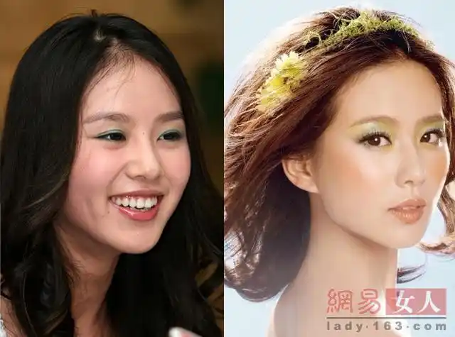 刘诗诗土气旧照曝光:肿脸小眼无神