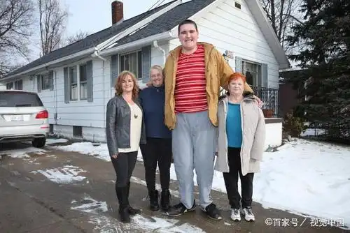 世界上最倒霉的人,既患上侏儒症又患上巨人症,网友:太矛盾了