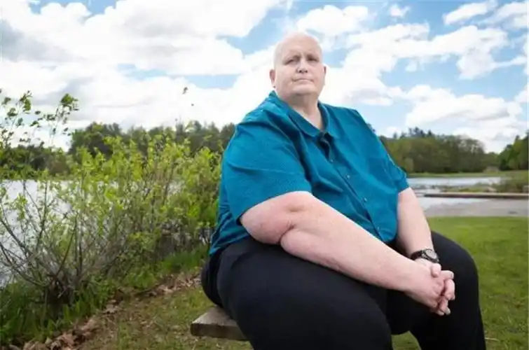 他的膝盖完全不能承受如今的体重