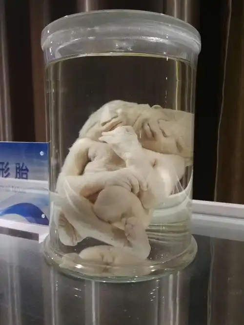 的重头戏——各种人体标本 看着一个个鲜活的生命被浸泡在福尔马林里