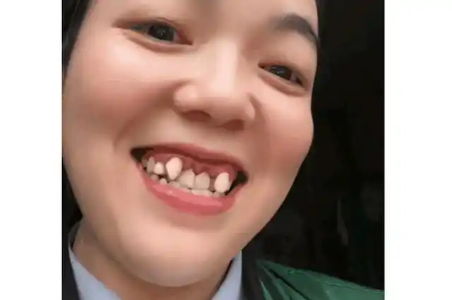 四川一位女子笑起来时露出虎牙而画面却有点夸张引来网友热议