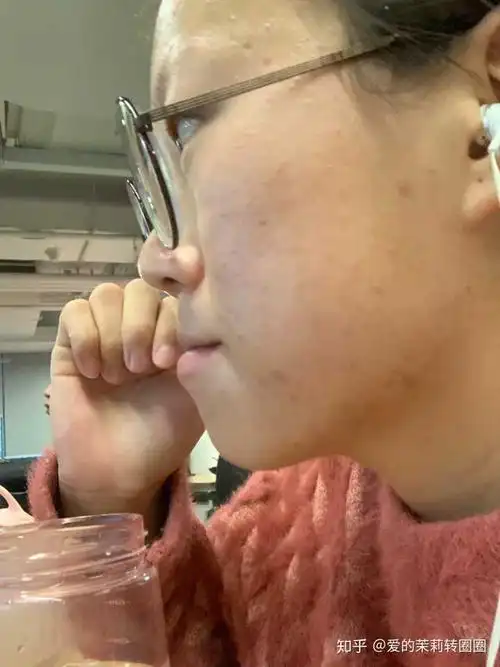 侧脸暴丑怎么办…还有救么…有图?