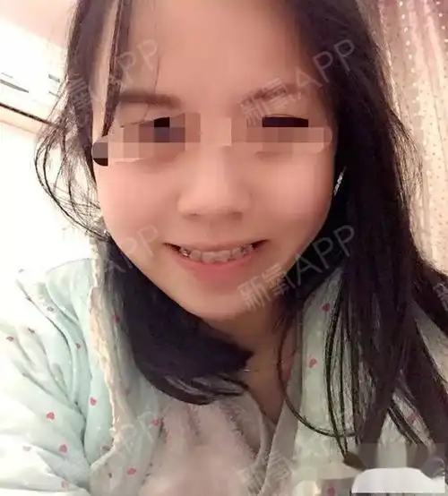 发个励志点的也想鼓励在犹豫不决的人们小时候12岁遇_圈子-新氧美容