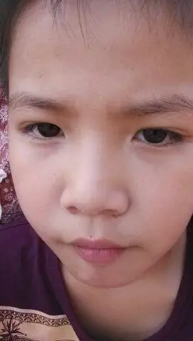 我是双眼皮 宝爸是单眼皮 生了两个女儿都是单眼皮_2015宝宝圈 - 妈妈