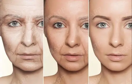 面部老化的3三种表现,看看你自己中了几条?