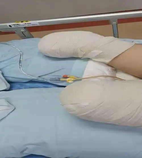 直属通道西青医院急诊科与120快速联动瞬间为一严重车