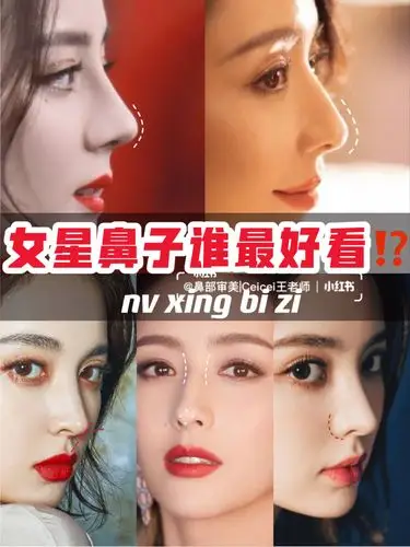 【鼻部审美】新疆三大女星的鼻子谁最好看?