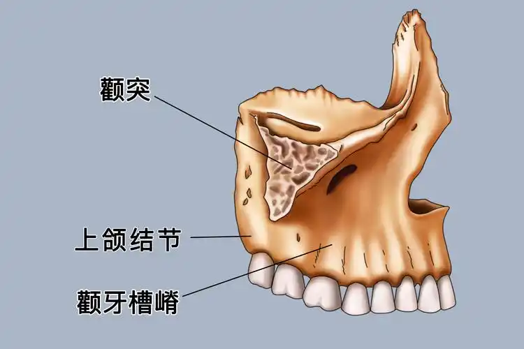临床上成年人多位于上颌第一磨牙与第二磨牙的上方,青少年多位于上颌
