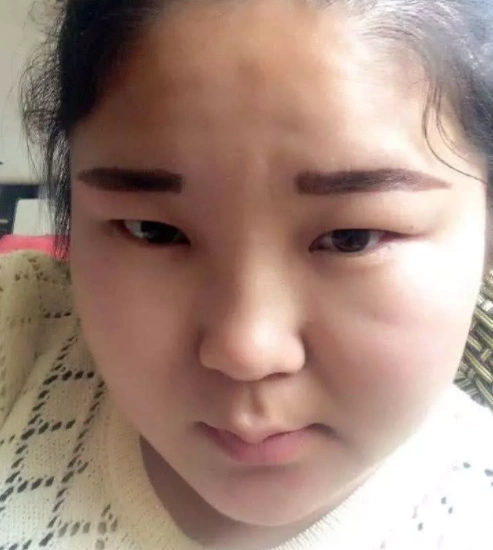 青春期女生鼻子"又塌又丑",只因常做这3件事,难怪你没异性缘