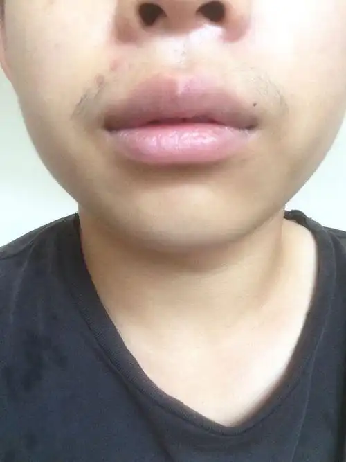 j为什么我人中这不长胡子 我20了