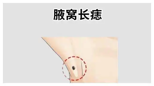 4颗"巨富"痣,一个升权,一个生金,前半生不差,后半生不穷!