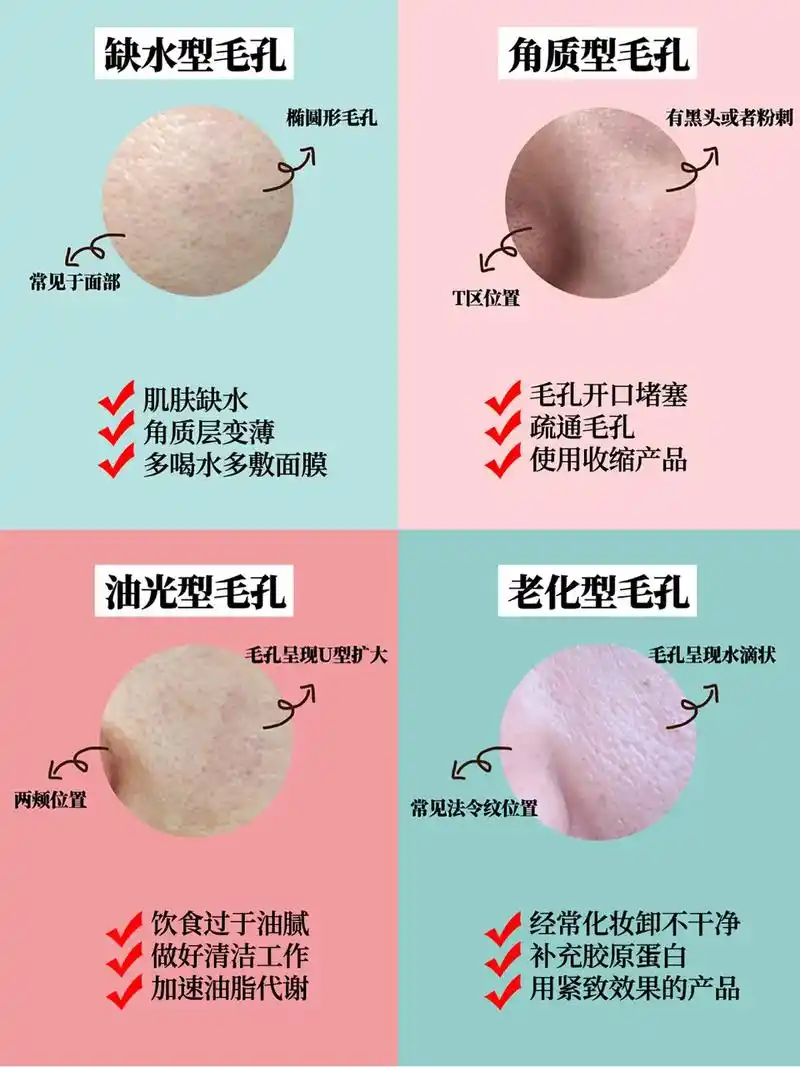 你是哪一种?正确护肤73毛孔粗大是很多人都有 - 抖音