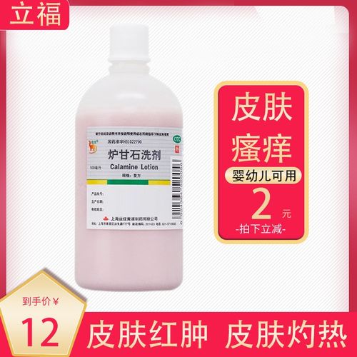 信龙 炉甘石洗剂 100ml  成人儿童急性皮肤瘙痒湿疹痱子外用止痒洗剂