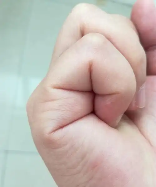 子女线双胞胎真手图,看手纹知道有几个孩子图1