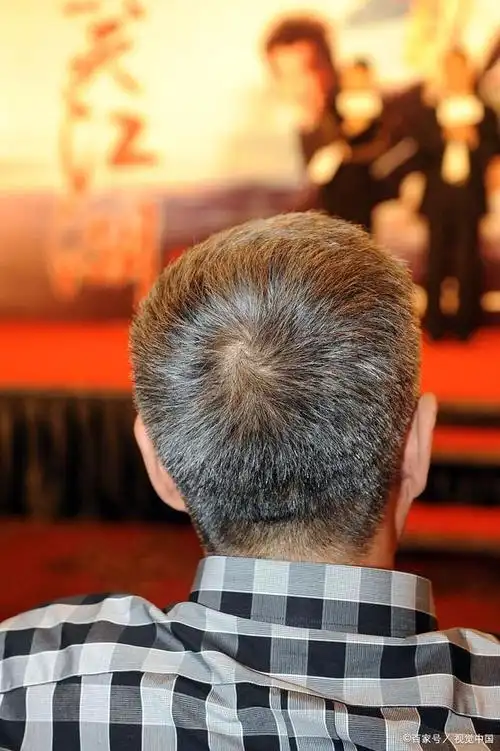 白发在哪病就从哪出?这些告诉你真相