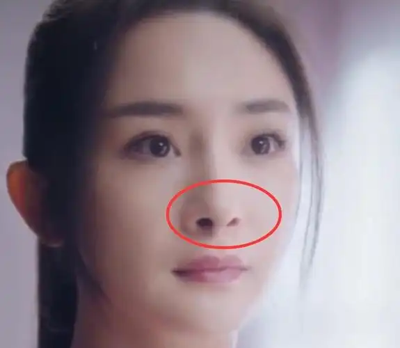 鼻孔外翻一大一小这10位明星都因鼻孔拉低了颜值