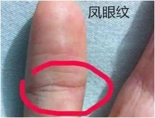 形成一个圈行的,像眼睛一样的手纹,就是我们常说的凤眼纹,或者为夫子