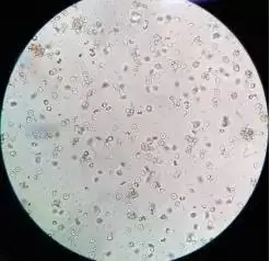 凝聚胺法交叉配血次侧凝集怎么破有图有真相