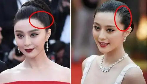 最立竿见影的方法就是去植发!