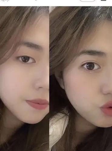 单眼皮双眼皮对比照片