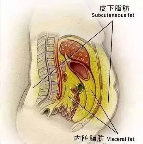 减肥误区:千万不能只减皮下脂肪