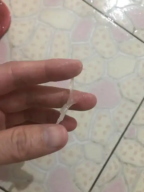 如何判断白带能拉丝?临近排卵时白带会出现拉丝