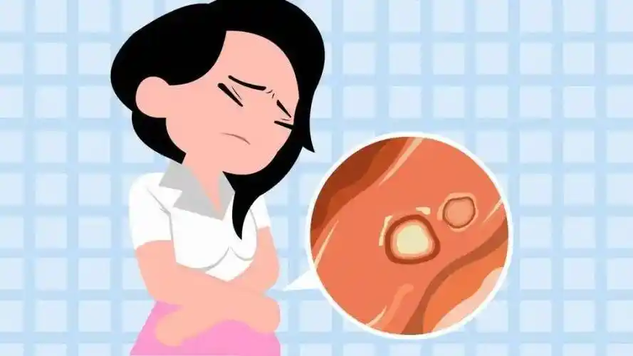 外阴发生溃疡,与私生活混乱有关吗?_女性_进行_治疗