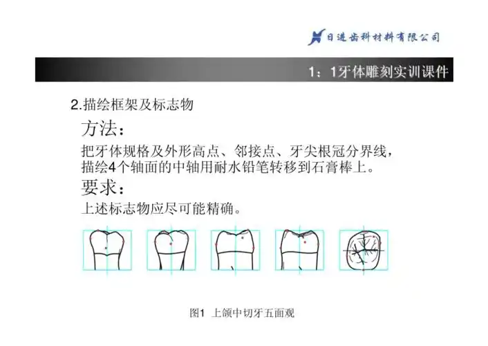 上颌一磨牙11雕刻