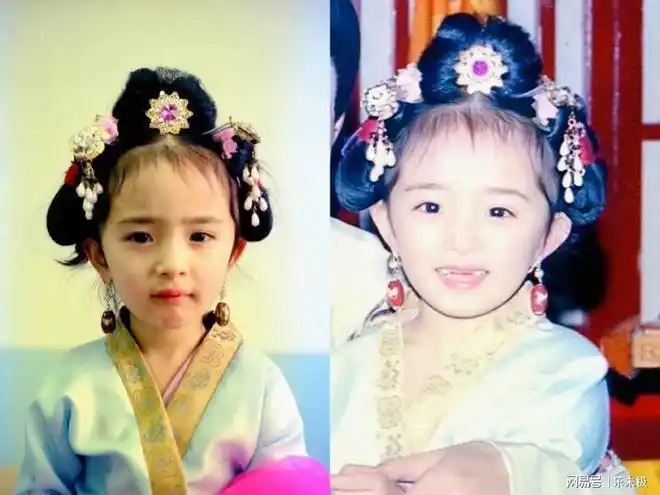 杨幂面临整容风波童年照揭露真相