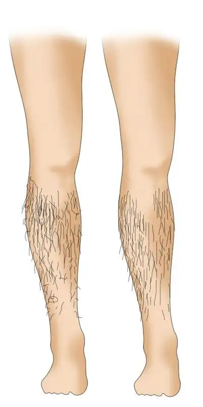 男生怎么打理腿毛