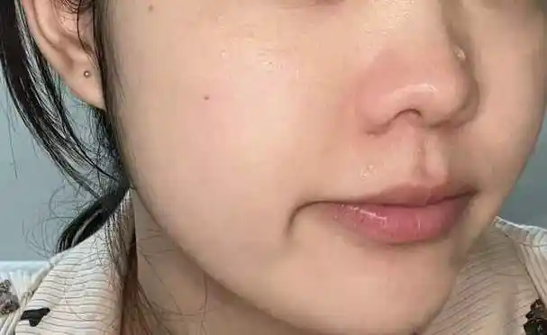 大红脸敏感肌都没了!_皮肤_感觉_情况