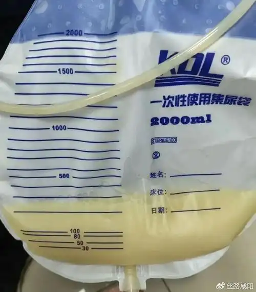 咸阳市中心医院新技术 1:乳糜漏怎么破?