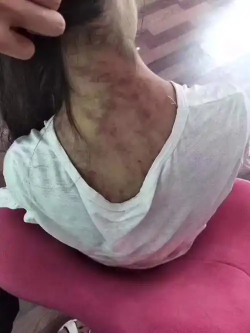 青海母亲燕志云虐女,滚油灌嘴纱线封口,被判7年,出狱挖坟泄愤_腾讯