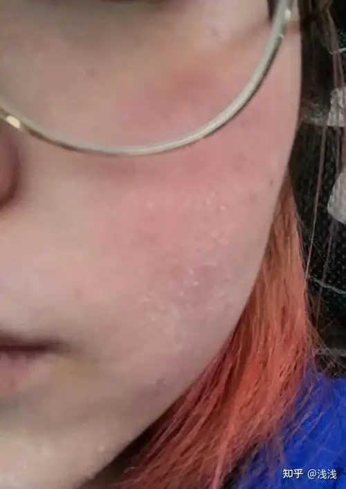 熬夜党皮肤差有什么护肤品推荐吗实测aoeo山茶花水乳套装变美也可以很