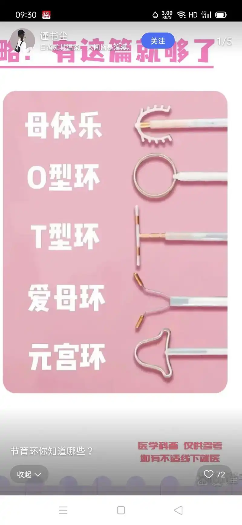 带你看看上的节育环,这就是我们做女人的不容易. - 抖音